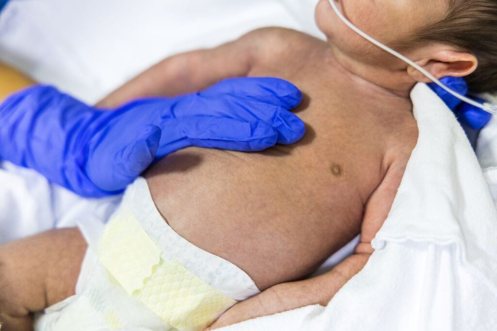 Santa Catarina registra mais de dois mil casos de Síndrome Respiratória Aguda Grave em 2025